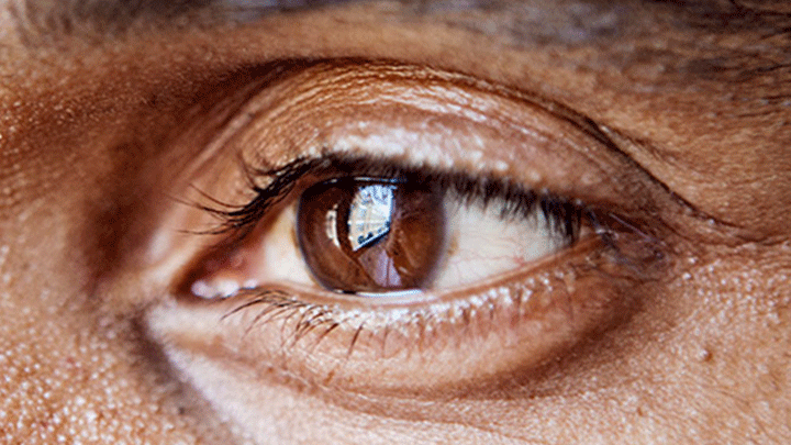 Sight test 