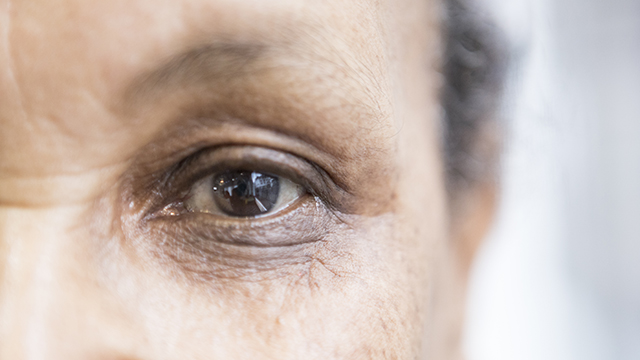 Laser treatment