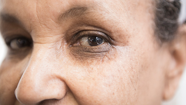 Smoking and eye health 