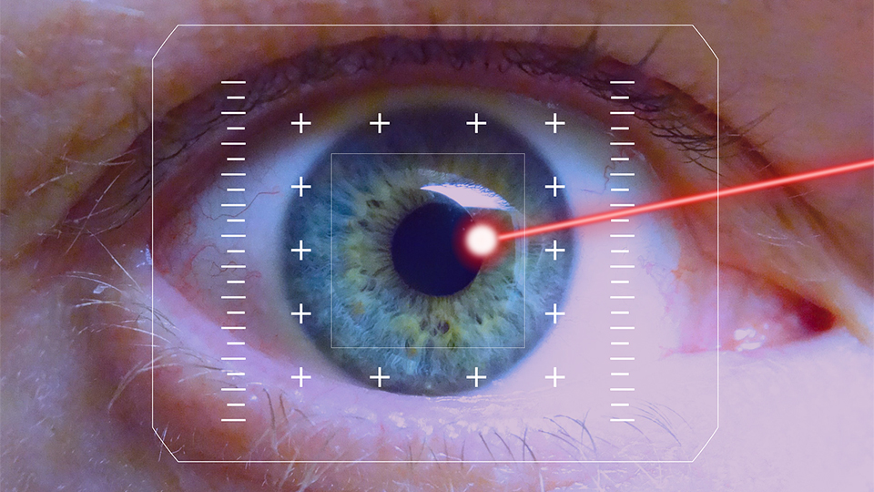 Eye surgery