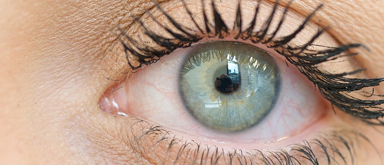 MGD oogaandoening header