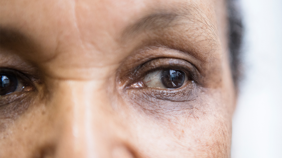 Brown eyes