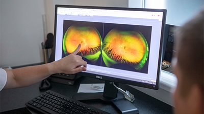 Optometrist showing patients eyes on a computer screen