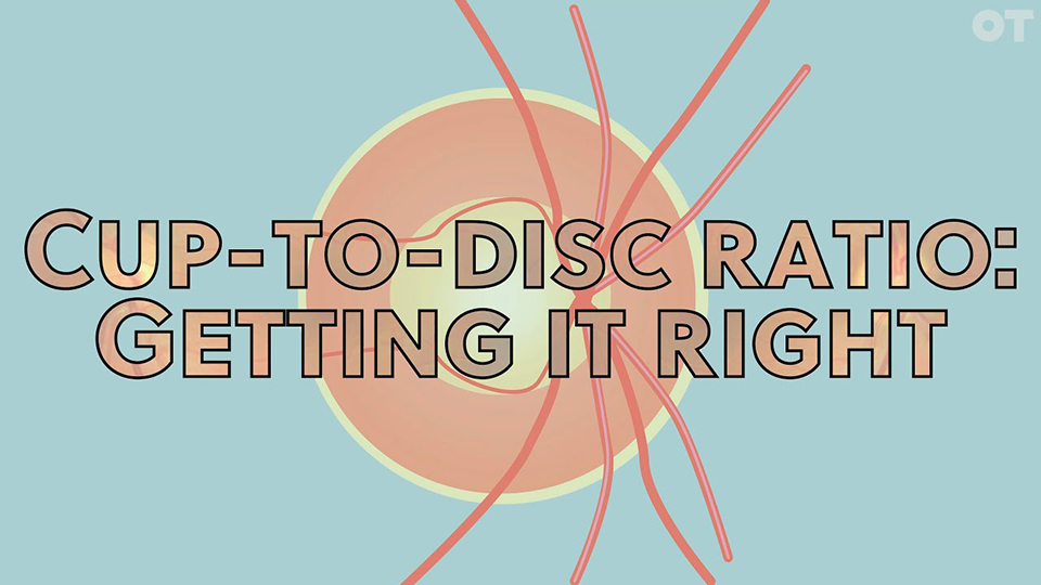 Cuptodisc ratio getting it right