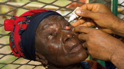 eye drop treatment for cataracts
