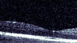 an OCT image of the retina captured with the Akepa first-generation chip