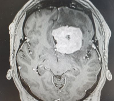 brain scan