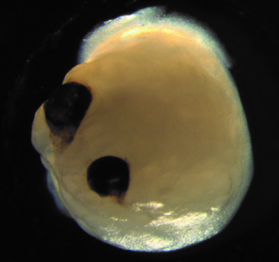 brain organoid with optic cups