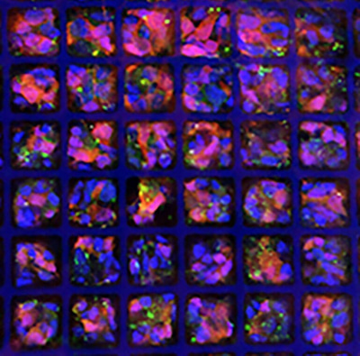 Photoreceptors