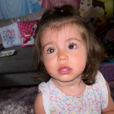 Young child shows a sign of retinoblastoma