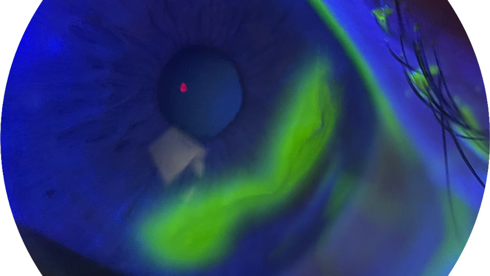 Anterior segment images captured by Hamza Mussa