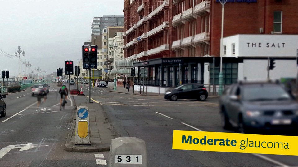The same photo of a busy road in a coastal town, but blur has been placed in several areas of the image to indicate moderate glaucoma vision loss