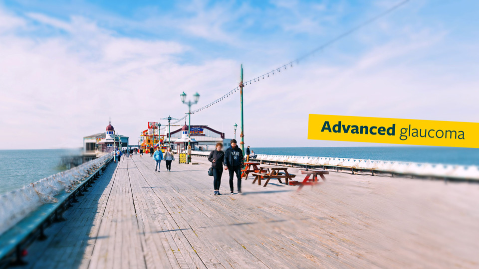 In this third image of the seaside pier, several of the red picnic benches have disappeared behind a blur overlaid on the image indicating advanced glaucoma