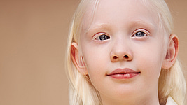 albino child