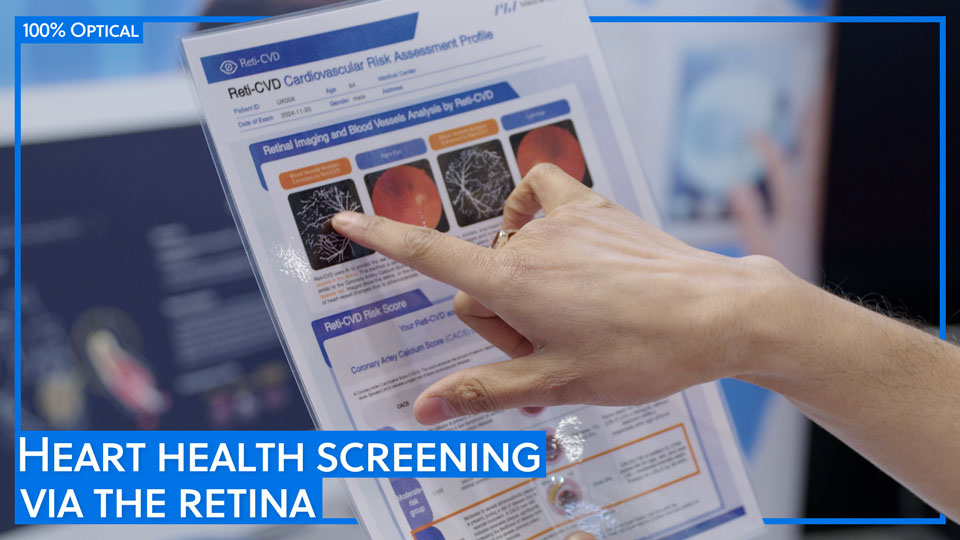 A print-out showing images of the eye and vessel tree. A blue box with white text states: Heart health screening via the retina