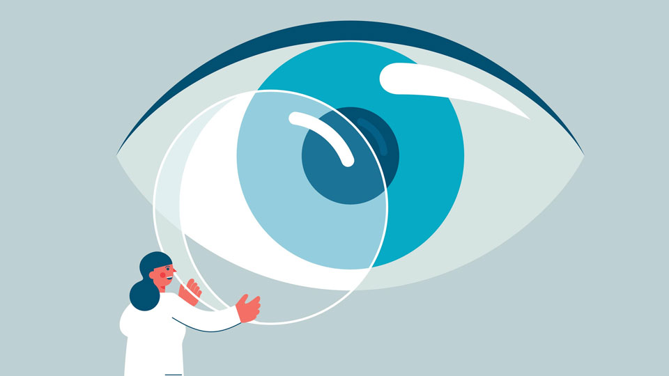 Illustration of a person holding a contact lens