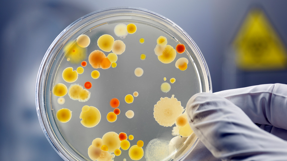 A gloved hand holds up a petrie dish with bacterial colonies