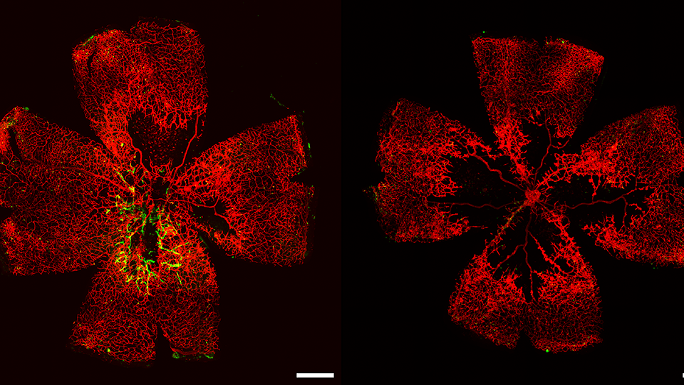 A mouse retina with diabetic retinopathy before (on right) and after (left) treatment with lab-grown retinal endothelial cells