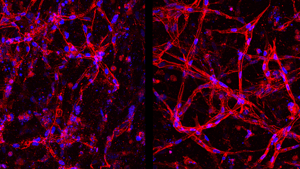 Retinal endothelial cells