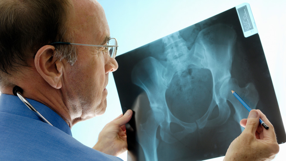 A clinician examines an x-ray of a pelvis