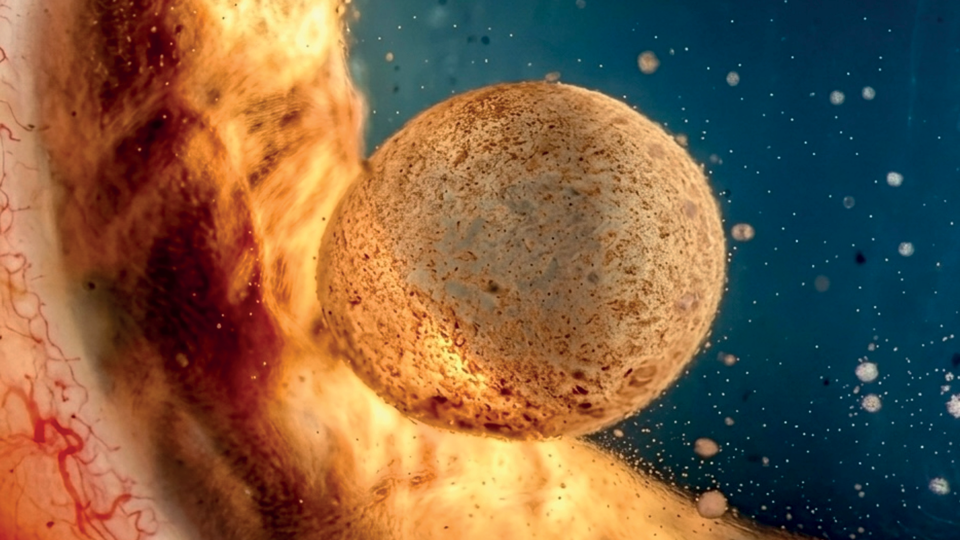 A macro image of an iris, which appears in light and dark shades of brown. In the foreground is a large speckled brown bubble. Around it are little white and brown specs. The effect is almost like an image of space
