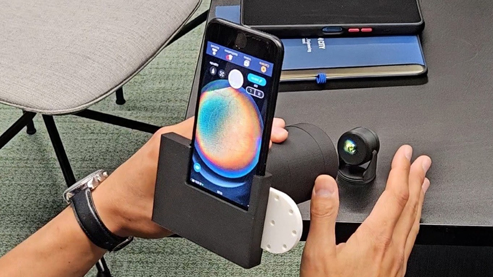 Smartphone eye disease screening project awarded £120,000 by Innovate UK