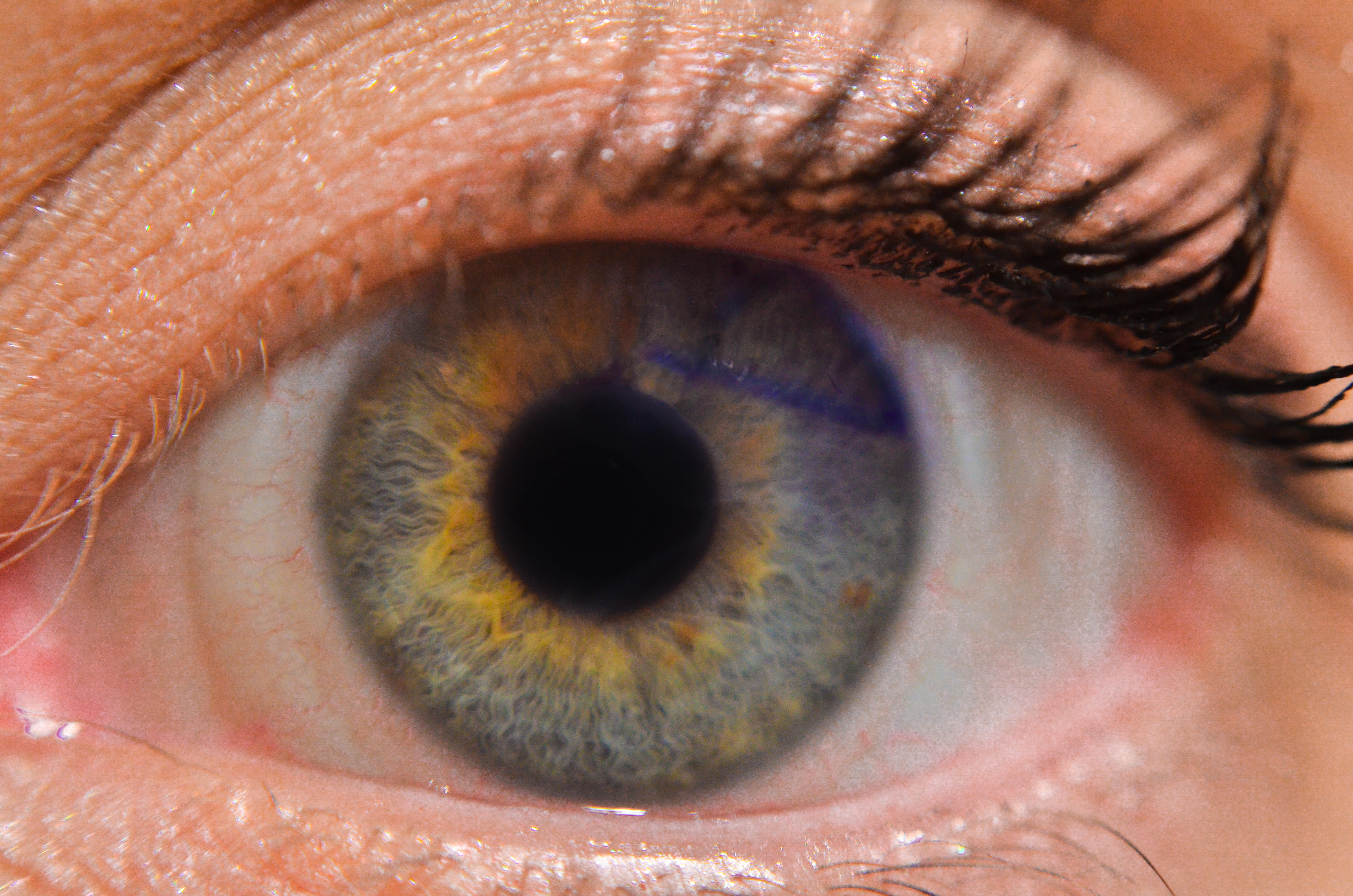 A close-up image of an eye with the NuVision Omnigen lens – this is evidence by a tiny purple triangle motif layered over the iris