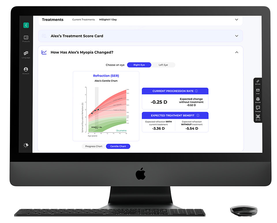A computer screen displays charts from myopia management software