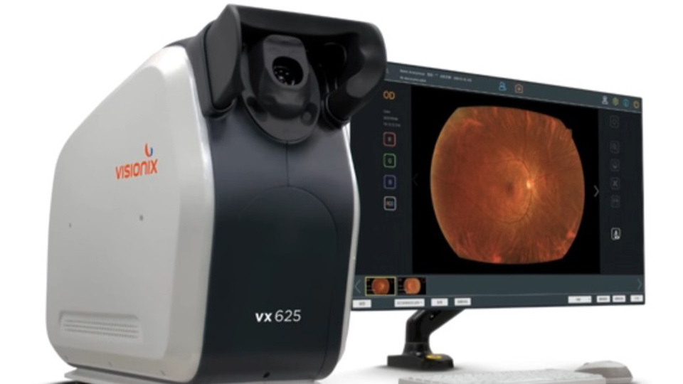 The Visionix device and a PC screen displaying a retinal image