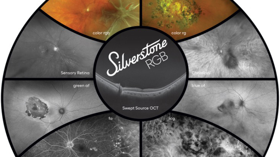 An image capture of the retina with a small OCT display  