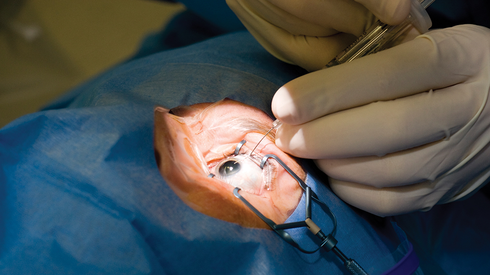 Closeup of surgeons hands performing manual eye surgery