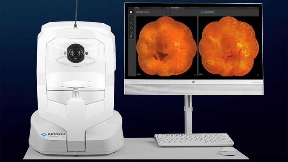 A white scanning device photographed next to a computer monitor with two scans of an eye in a collage