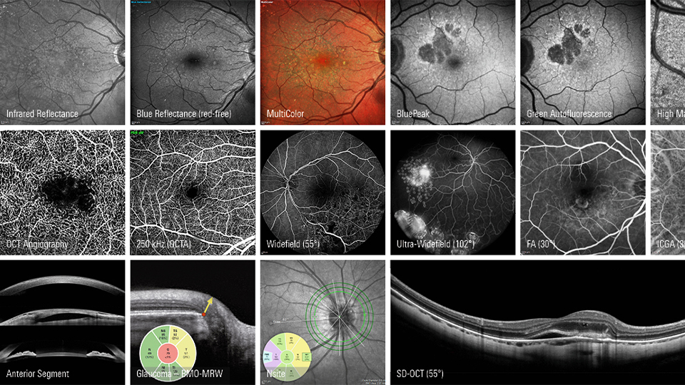 A collage of different scans obtained through the company’s imaging solution. Most are in black and white except for the multicolour slide and a few wheels indicating potential glaucoma. The frame is split into 15 smaller squares and one long scan