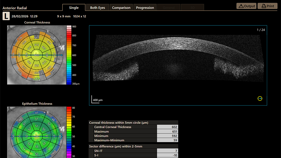 A black and white scan image of the inside of an eye. To the left are two wheels, one in shades of yellow and orange and one in shades of green, each providing a clinical indication