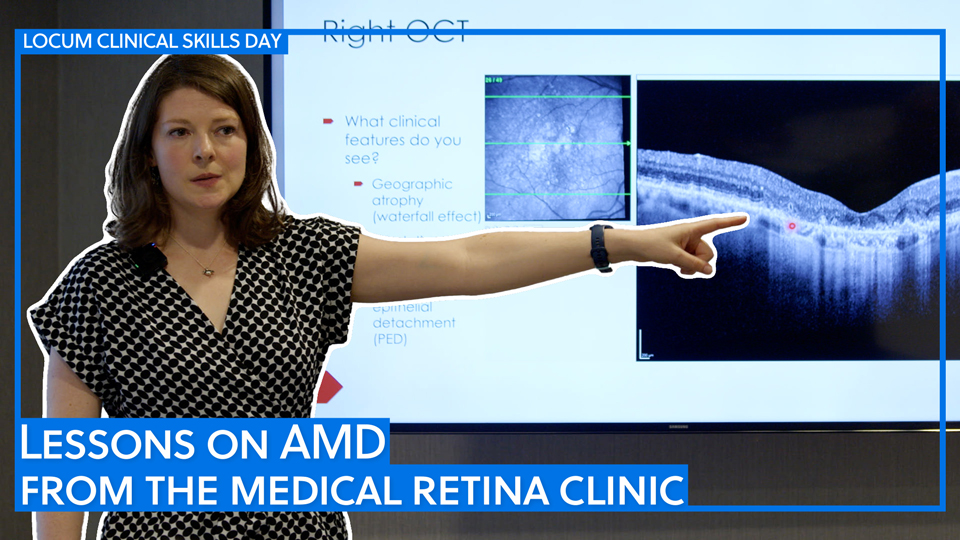 A woman giving a clinical presentation on age-related macular degeneration (AMD) points toward an optical coherence tomography (OCT) scan displayed on a screen. She stands beside the projected slides, which show retinal images and clinical notes. A banner reads “Locum Clinical Skills Day,” and text at the bottom says “Lessons on AMD from the Medical Retina Clinic.” 