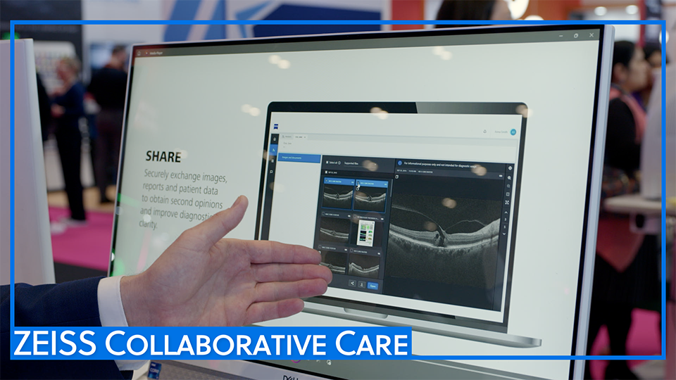 Title card of a video with a hand and Zeiss collaborative care on a screen at 100% Optical