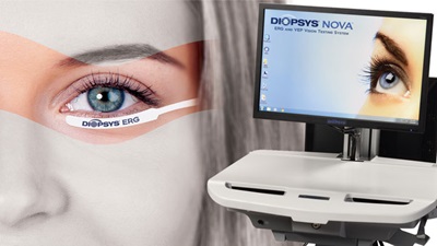 Lady with Diopsys tab under her eye