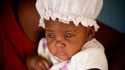 Young baby with cataracts