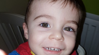 A child with Retinoblastoma