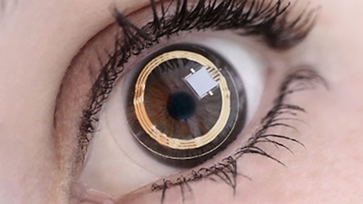 Smart contact lenses help predict glaucoma progression