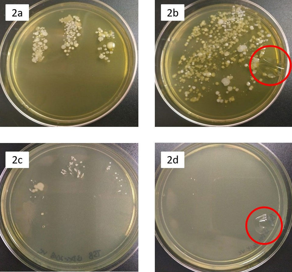 Bacteria on contact lenses 