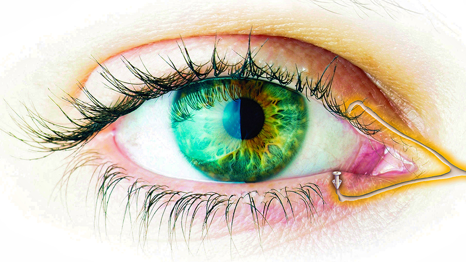 Parasol dry eye products