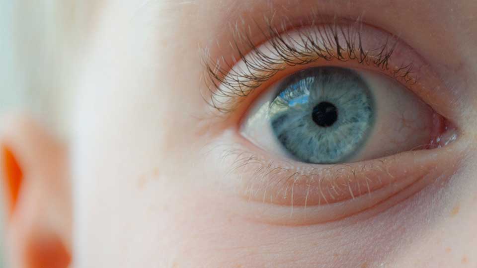 Eye