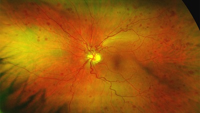Retinal scan