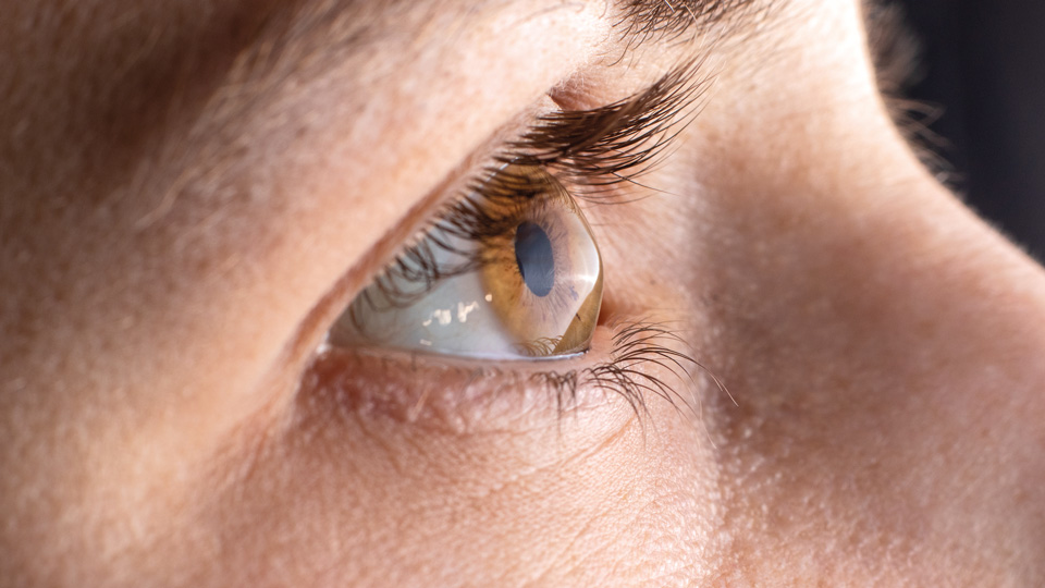 contact lens in eye