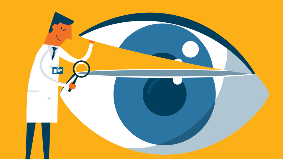 Eye