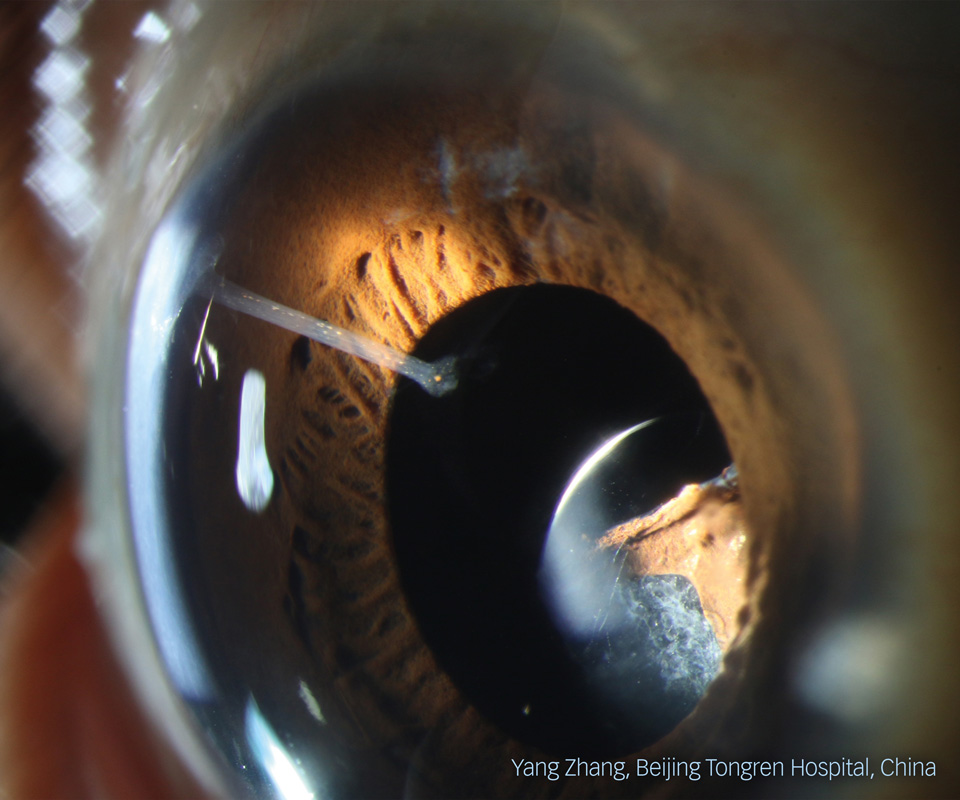 Image shows a macro photograph of an eye taken from a nearly side-on view. The curve of the eye catches the light, which illuminates the inside of the eye