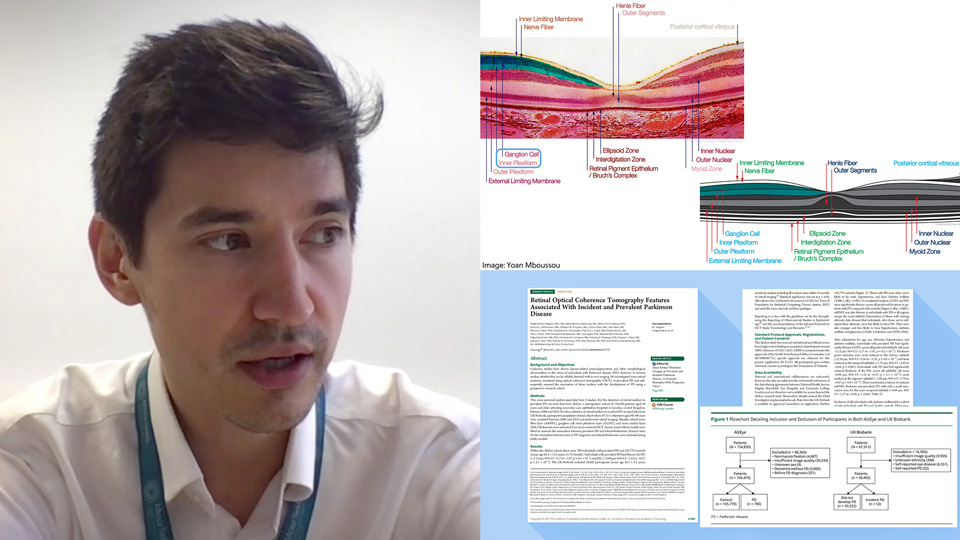 A man in his 30s with dark hair, a white shirt and a lanyard faces towards the camera. On half of the screen are two illustrations – an anatomical diagram of the eye, and an image of a scientific paper