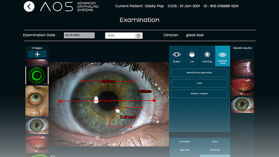 A display of the Advanced Ophthalmic Services software