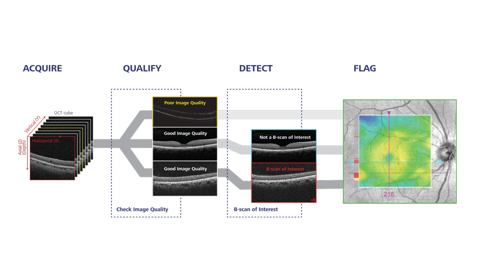 A diagram of the image assessment guided by AI, going through stages: acquire, qualify, detect, flag